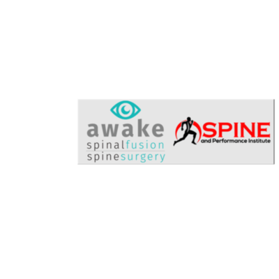 Awake Spinal Fusion&thinsp;